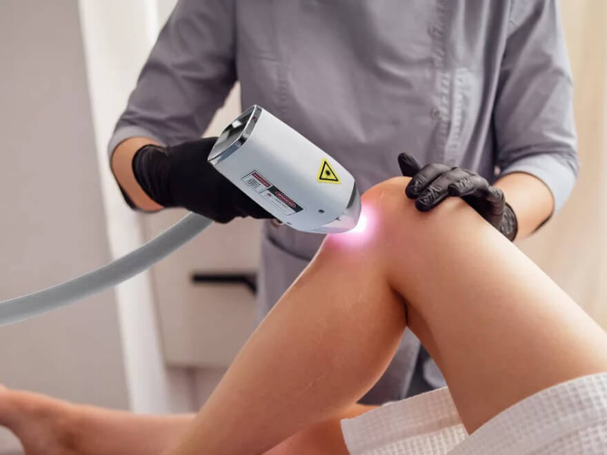 Épilation Laser Corps