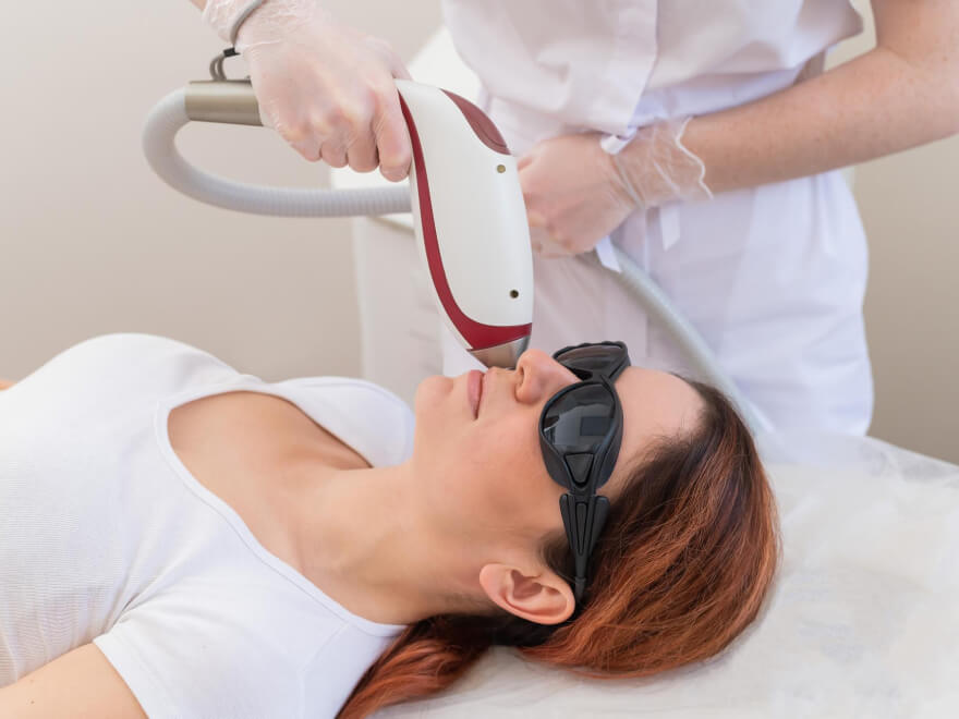 Epilation Laser du Visage
