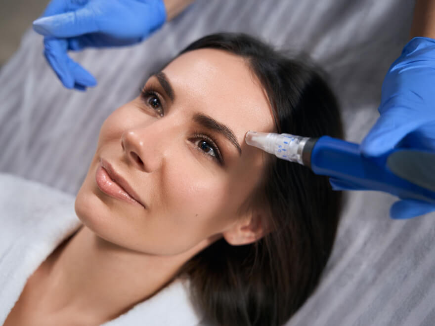 Microneedling anti-âge