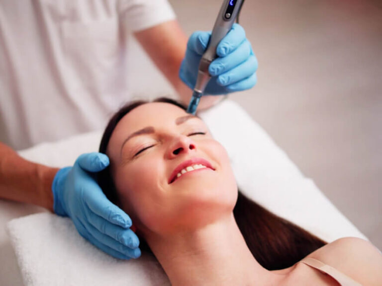 Risques Microneedling RF