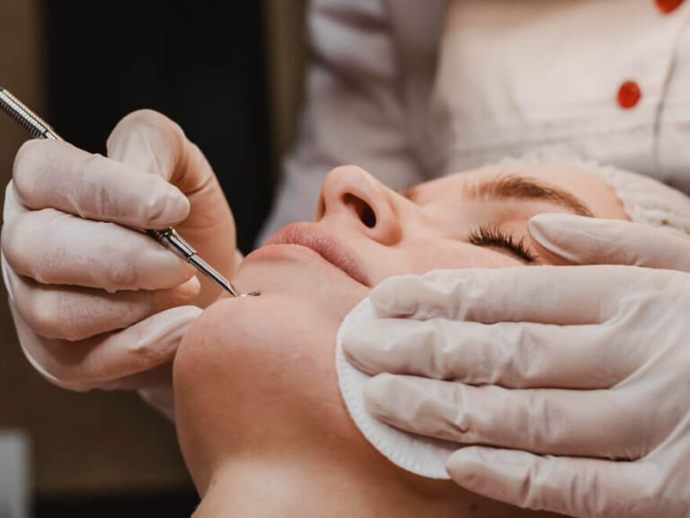 Pourquoi les humains ont de l'acne et est-ce uniquement humain