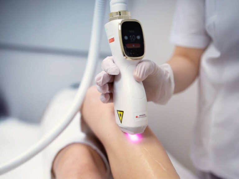 IPL epilation definitive: guide peau et resultats