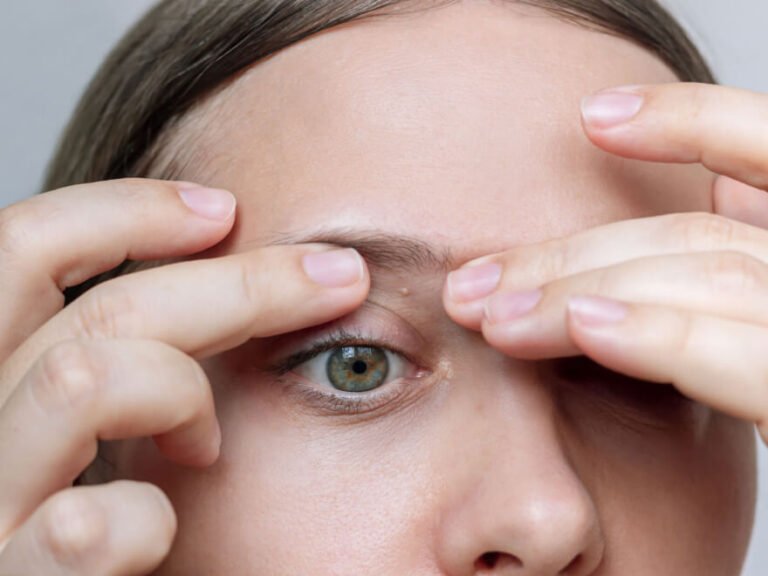 Grain de milium: comment les reconnaitre et agir sans agresser la peau