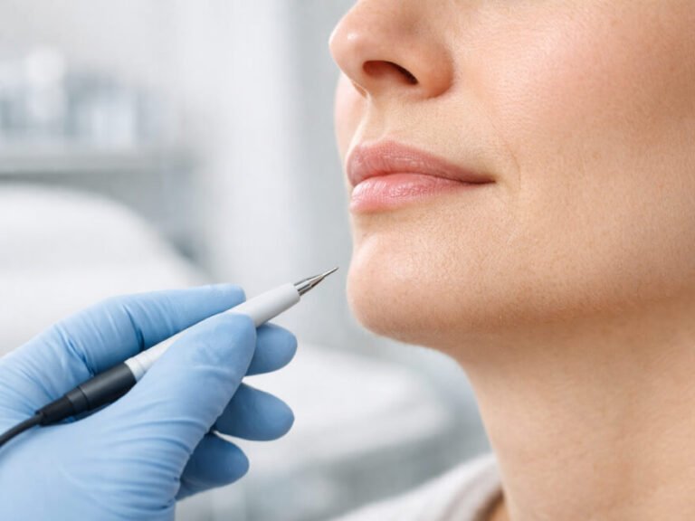 Electrolyse visage: guide pratique et avis utile