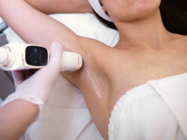 Consultation de séance d épilation laser avec estimation tarifaire