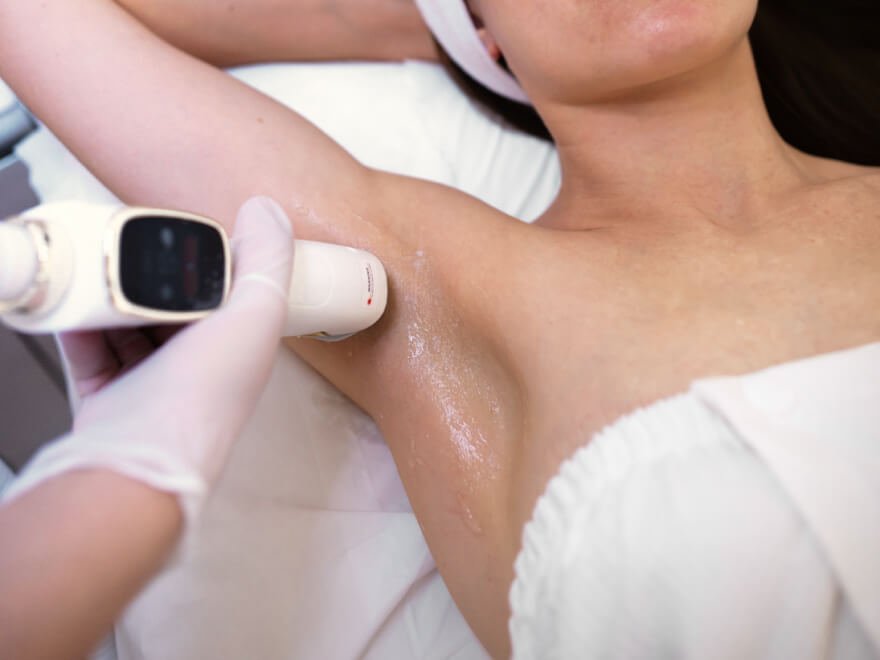 Consultation de séance d épilation laser avec estimation tarifaire