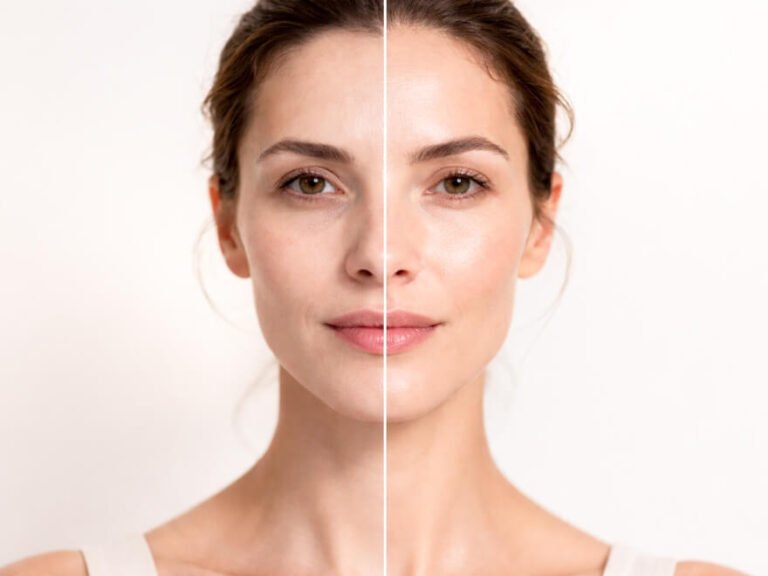 Ce que montre un teint blême en pratique